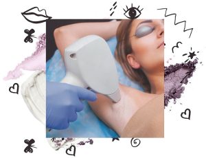 laser hair removal waterloo